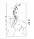 Fig. 65 - SYSTEM AND METHOD FOR IMAGE-GUIDED ARTHROSCOPY