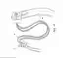 Fig. 07 - Adjustable suture-button constructs for ligament reconstruction