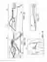 Fig. 11 - Adjustable suture-button constructs for ligament reconstruction