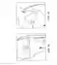 Fig. 14 - Adjustable suture-button constructs for ligament reconstruction