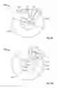 Fig. 16 - TISSUE MATRICES AND METHODS OF TREATMENT