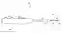 Fig. 01 - Suturing devices and methods for suturing an anatomic structure