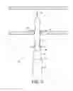 Fig. 12 - Suturing devices and methods for suturing an anatomic structure