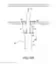 Fig. 14 - Suturing devices and methods for suturing an anatomic structure