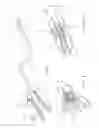 Fig. 07 - Apparatus and method for resectioning gastro-esophageal tissue