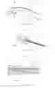 Fig. 10 - Apparatus and method for resectioning gastro-esophageal tissue