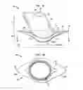 Fig. 02 - Implantable flow connector