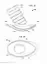 Fig. 14 - Implantable flow connector
