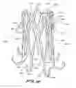 Fig. 34 - Implantable flow connector
