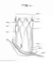 Fig. 55 - Implantable flow connector