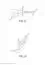 Fig. 11 - Method and system for ligating a body part