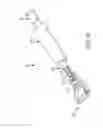 Fig. 15 - Method and system for ligating a body part