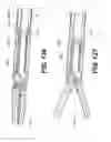 Fig. 106 - Automatic surgical ligation clip applier
