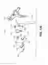 Fig. 108 - Automatic surgical ligation clip applier