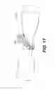 Fig. 15 - Automatic surgical ligation clip applier