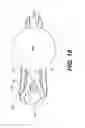 Fig. 16 - Automatic surgical ligation clip applier