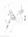 Fig. 17 - Automatic surgical ligation clip applier