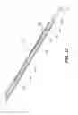 Fig. 21 - Automatic surgical ligation clip applier