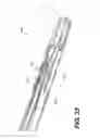 Fig. 29 - Automatic surgical ligation clip applier