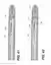 Fig. 34 - Automatic surgical ligation clip applier