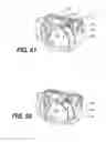 Fig. 42 - Automatic surgical ligation clip applier