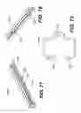 Fig. 56 - Automatic surgical ligation clip applier