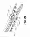 Fig. 66 - Automatic surgical ligation clip applier