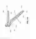 Fig. 82 - Automatic surgical ligation clip applier