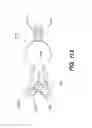 Fig. 84 - Automatic surgical ligation clip applier