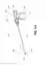 Fig. 85 - Automatic surgical ligation clip applier