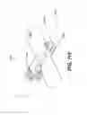 Fig. 87 - Automatic surgical ligation clip applier