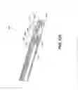 Fig. 91 - Automatic surgical ligation clip applier