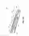 Fig. 93 - Automatic surgical ligation clip applier
