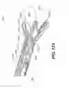 Fig. 94 - Automatic surgical ligation clip applier