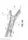 Fig. 95 - Automatic surgical ligation clip applier