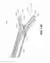 Fig. 97 - Automatic surgical ligation clip applier