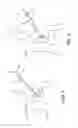 Fig. 03 - METHOD AND APPARATUS FOR TREATING VARICOSE VEINS