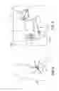 Fig. 04 - METHOD AND APPARATUS FOR TREATING VARICOSE VEINS