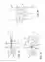 Fig. 09 - METHOD AND APPARATUS FOR TREATING VARICOSE VEINS