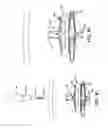 Fig. 32 - METHOD AND APPARATUS FOR TREATING VARICOSE VEINS