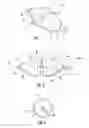Fig. 02 - MEDICAL DEVICES FOR TREATING A TARGET SITE AND ASSOCIATED METHOD