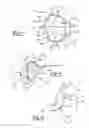 Fig. 03 - Apparatus and method for repairing bone defects
