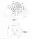 Fig. 06 - Apparatus and method for repairing bone defects