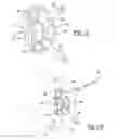 Fig. 09 - Apparatus and method for repairing bone defects