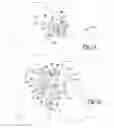 Fig. 11 - Apparatus and method for repairing bone defects
