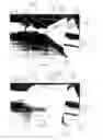 Fig. 07 - Systems and methods for removing undesirable material within a circulatory system utilizing a balloon catheter
