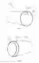 Fig. 08 - Systems and methods for removing undesirable material within a circulatory system utilizing a balloon catheter