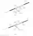 Fig. 09 - Systems and methods for removing undesirable material within a circulatory system utilizing a balloon catheter
