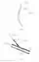 Fig. 10 - Systems and methods for removing undesirable material within a circulatory system utilizing a balloon catheter