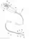 Fig. 01 - Body cavity foreign matter capture instrument